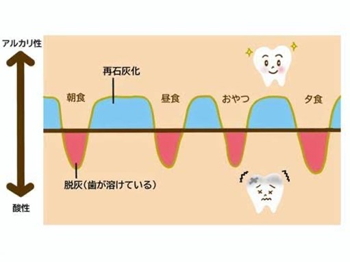 どうして虫歯はできるのか？02