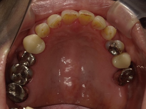 Before