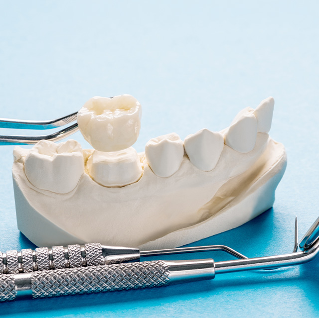 熟練した歯科技工士との連携