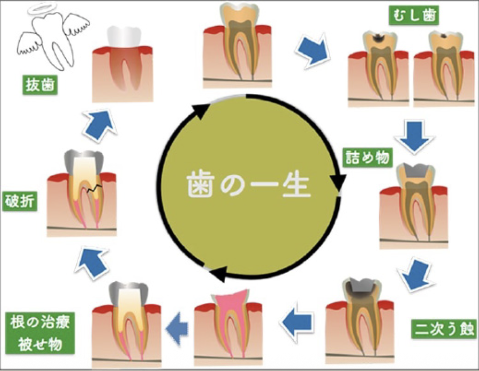 歯の一生