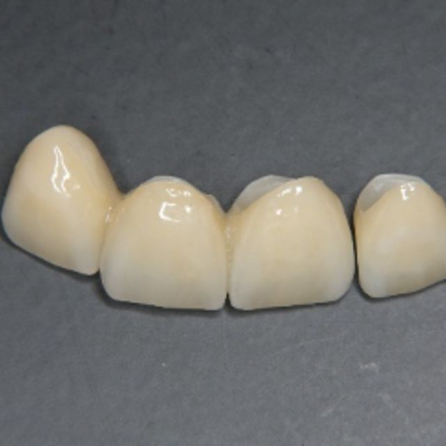 熟練した歯科技工士との連携