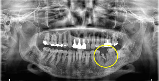 患者さまのお悩み